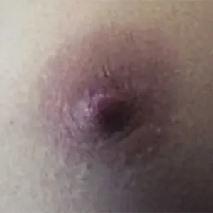 Show the Nipple