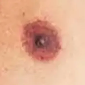 Show the Nipple